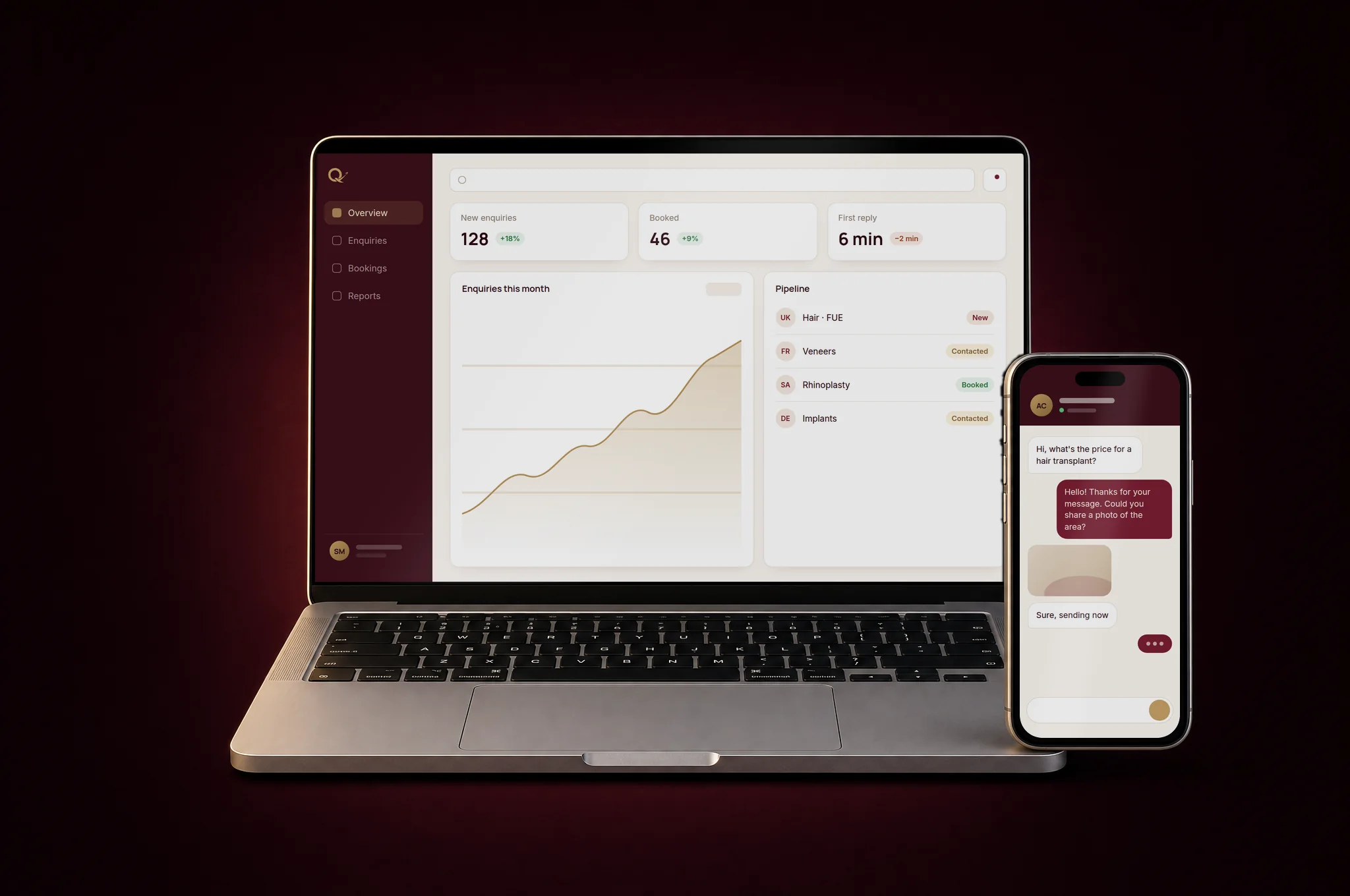 Interface example